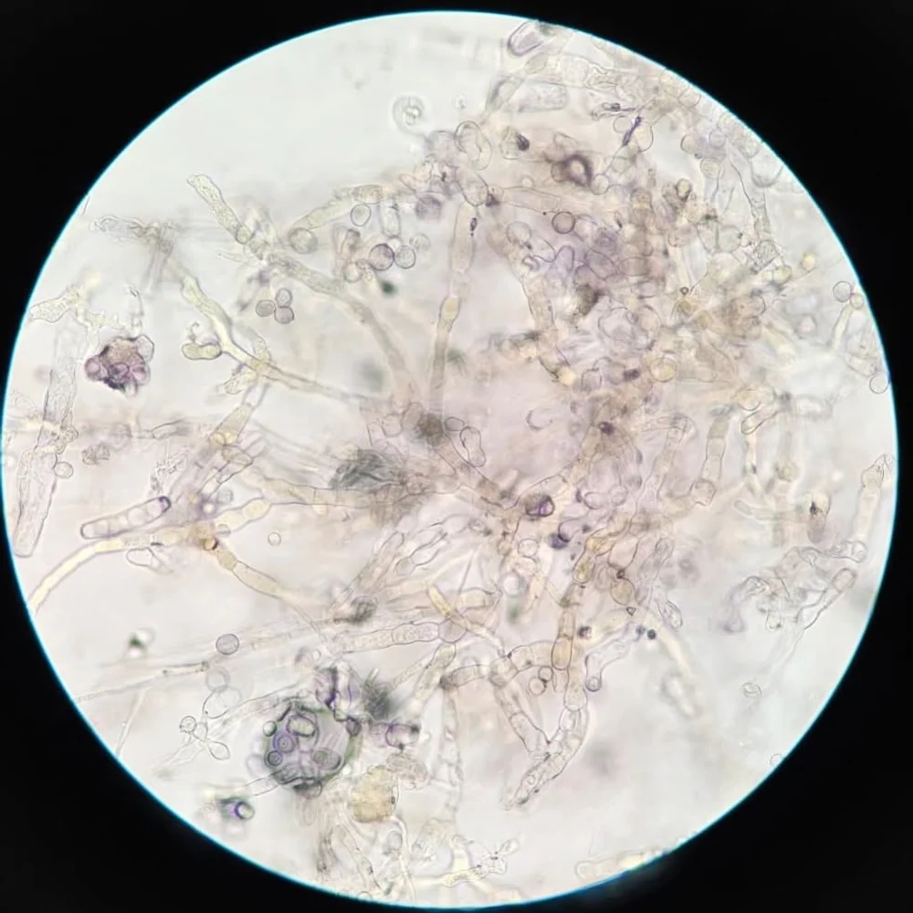 hifas de hongos en el microscopio